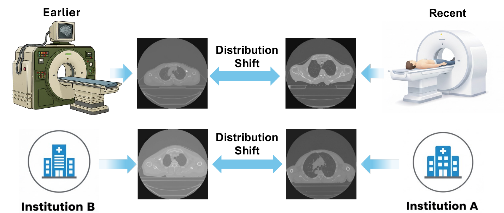 Distribution shift in CT scans across scanners and institutions